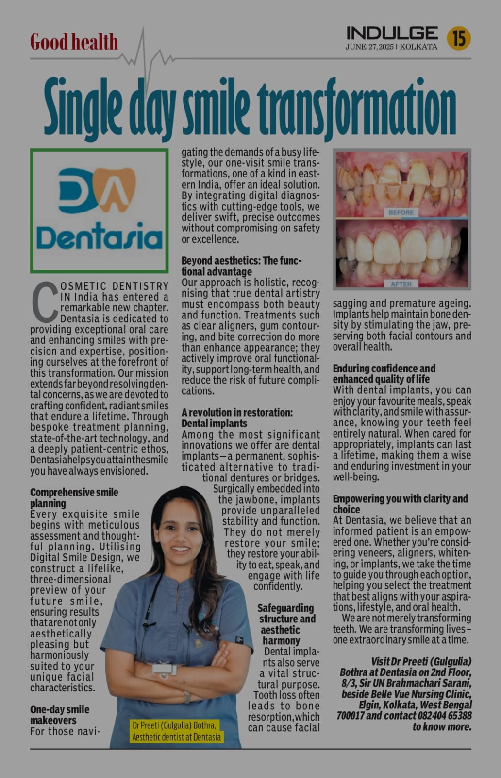 Single day smile transformation